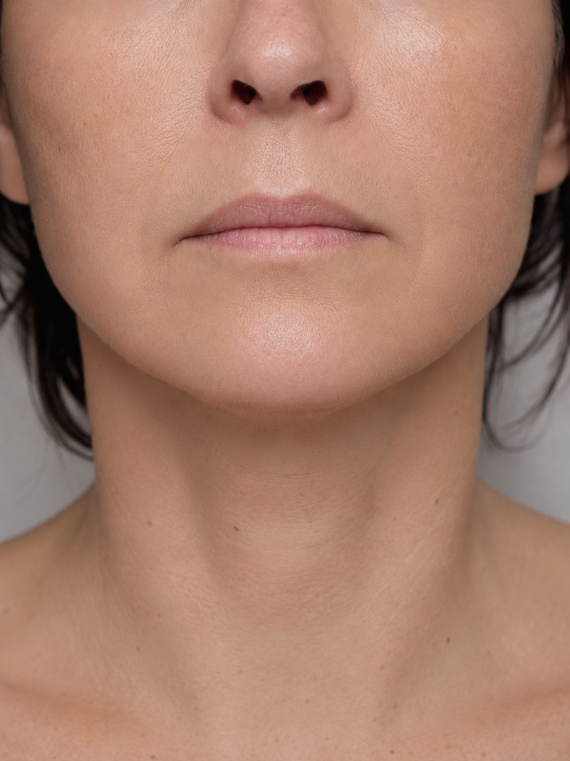 Sarah M., 48 — 6 weeks · Firmness & fine lines